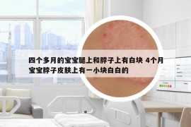 四个多月的宝宝腿上和脖子上有白块 4个月宝宝脖子皮肤上有一小块白白的