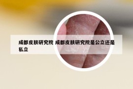 成都皮肤研究院 成都皮肤研究院是公立还是私立