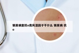 银屑病查抗o类风湿因子干什么 银屑病 抗o