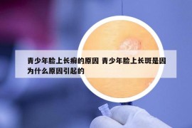 青少年脸上长癣的原因 青少年脸上长斑是因为什么原因引起的