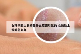 女孩子脸上长癣是什么原因引起的 女孩脸上长癣怎么办