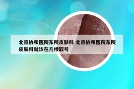 北京协和医院东院皮肤科 北京协和医院东院皮肤科就诊在几楼取号