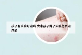 孩子有头癣好治吗 大家孩子得了头癣怎么治疗的