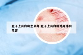 肚子上有白斑怎么办 肚子上有白斑对身体的危害