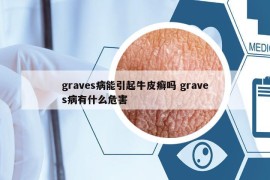 graves病能引起牛皮癣吗 graves病有什么危害