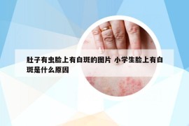 肚子有虫脸上有白斑的图片 小学生脸上有白斑是什么原因