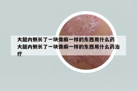 大腿内侧长了一块像癣一样的东西用什么药 大腿内侧长了一块像癣一样的东西用什么药治疗