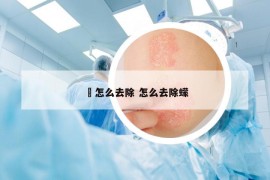 廯怎么去除 怎么去除蠓