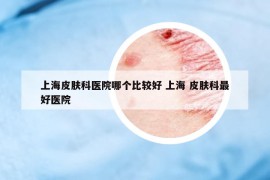 上海皮肤科医院哪个比较好 上海 皮肤科最好医院