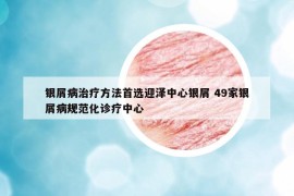 银屑病治疗方法首选迎泽中心银屑 49家银屑病规范化诊疗中心