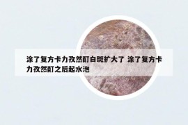 涂了复方卡力孜然酊白斑扩大了 涂了复方卡力孜然酊之后起水泡