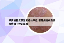 银屑病糖皮质激素疗效不佳 银屑病糖皮质激素疗效不佳的原因