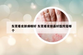 东莞看皮肤病哪好 东莞看皮肤最好医院是哪个