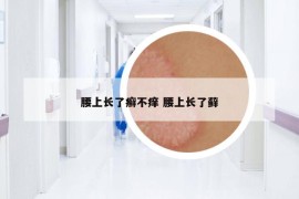 腰上长了癣不痒 腰上长了藓