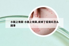 小腿上有藓 小腿上有藓,皮掉了后变红怎么回事