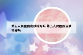 第五人民医院皮肤科好吗 第五人民医院皮肤科好吗