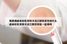 银屑病卤米松乳膏和卡泊三醇软膏先抹什么 卤米松乳膏和卡泊三醇软膏能一起用吗