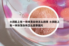 小孩脸上有一块快发白块怎么回事 小孩脸上有一块快发白块怎么回事图片