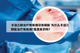 卡泊三醇治疗银屑病没有缓解 为什么卡泊三醇能治疗银屑病?是激素药吗?