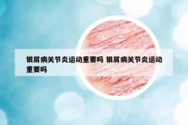 银屑病关节炎运动重要吗 银屑病关节炎运动重要吗