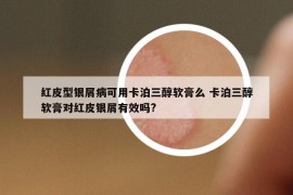 红皮型银屑病可用卡泊三醇软膏么 卡泊三醇软膏对红皮银屑有效吗?