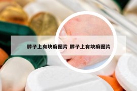 脖子上有块癣图片 脖子上有块癣图片