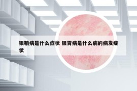 银鞘病是什么症状 银霄病是什么病的病发症状