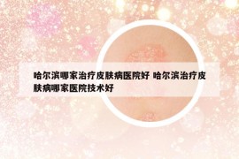 哈尔滨哪家治疗皮肤病医院好 哈尔滨治疗皮肤病哪家医院技术好