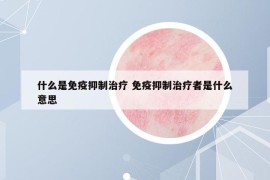 什么是免疫抑制治疗 免疫抑制治疗者是什么意思