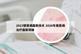 2023银屑病最新技术 2020年银屑病治疗最新突破