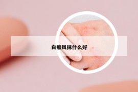 白癜风抹什么好