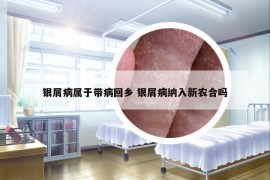 银屑病属于带病回乡 银屑病纳入新农合吗