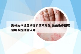 激光治疗银屑病哪家医院能做 激光治疗银屑病哪家医院能做好