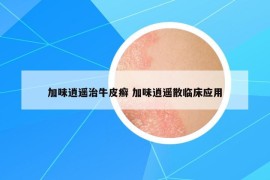 加味逍遥治牛皮癣 加味逍遥散临床应用