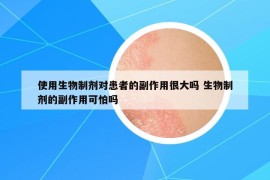 使用生物制剂对患者的副作用很大吗 生物制剂的副作用可怕吗