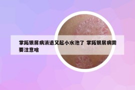 掌跖银屑病消退又起小水泡了 掌跖银屑病需要注意啥