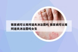 银屑病可以用阿道夫沐浴露吗 银屑病可以用阿道夫沐浴露吗女生