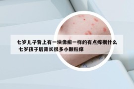 七岁儿子背上有一块像癣一样的有点痒摸什么 七岁孩子后背长很多小颗粒痒