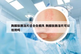 胸腺肽肠溶片适合白癜风 胸腺肽肠溶片可以祛斑吗