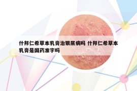 什邦仁希草本乳膏治银屑病吗 什邦仁希草本乳膏是国药准字吗