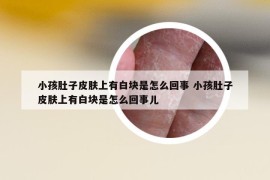 小孩肚子皮肤上有白块是怎么回事 小孩肚子皮肤上有白块是怎么回事儿