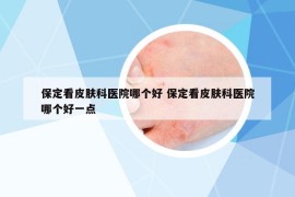 保定看皮肤科医院哪个好 保定看皮肤科医院哪个好一点