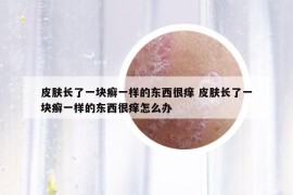 皮肤长了一块癣一样的东西很痒 皮肤长了一块癣一样的东西很痒怎么办