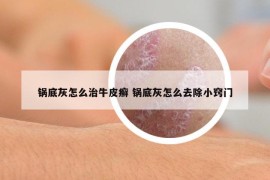 锅底灰怎么治牛皮癣 锅底灰怎么去除小窍门