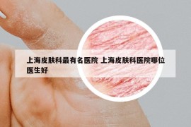上海皮肤科最有名医院 上海皮肤科医院哪位医生好