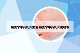 癣克宁中药乳膏主治 癣克宁中药乳膏说明书