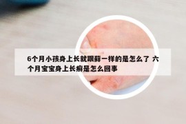 6个月小孩身上长就跟藓一样的是怎么了 六个月宝宝身上长癣是怎么回事