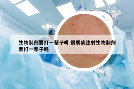 生物制剂要打一辈子吗 银屑病注射生物制剂要打一辈子吗