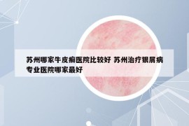 苏州哪家牛皮癣医院比较好 苏州治疗银屑病专业医院哪家最好