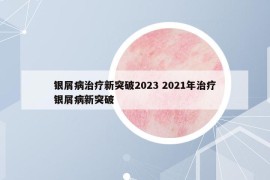 银屑病治疗新突破2023 2021年治疗银屑病新突破